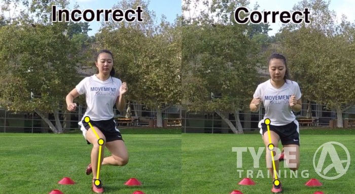 Poor Movement and Weak Hips Lead to ACL Tears