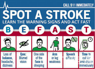 Stroke and Exercise for Seniors