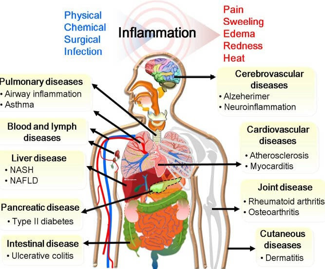 Inflammation Health Effects Understanding The Body s Response Inflammation Health Effects Understanding The Body s Response
