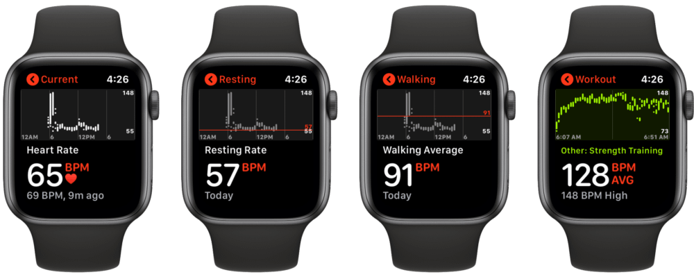Monitoring heart health with the Apple Watch