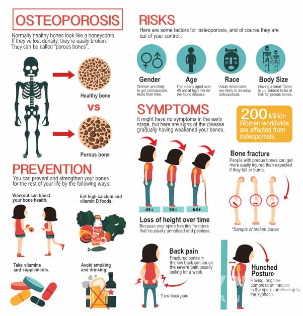 Understanding Osteoporosis and Exercise for Seniors