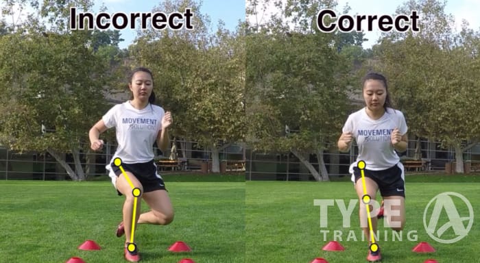 Poor Movement and Weak Hips Lead to ACL Tears