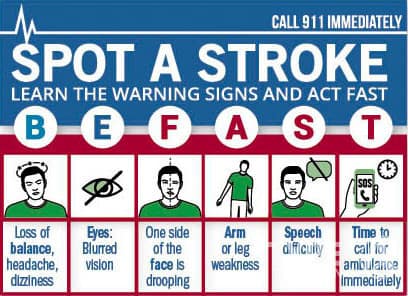 Stroke and Exercise for Seniors