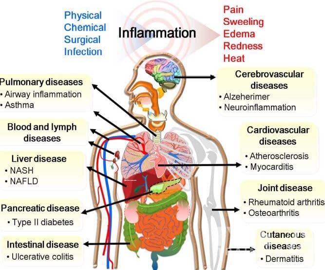 Inflammation and Chronic Illness