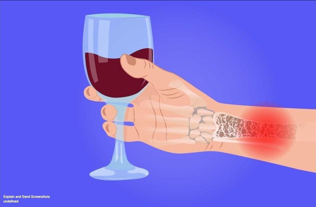 Drinking osteoporosis