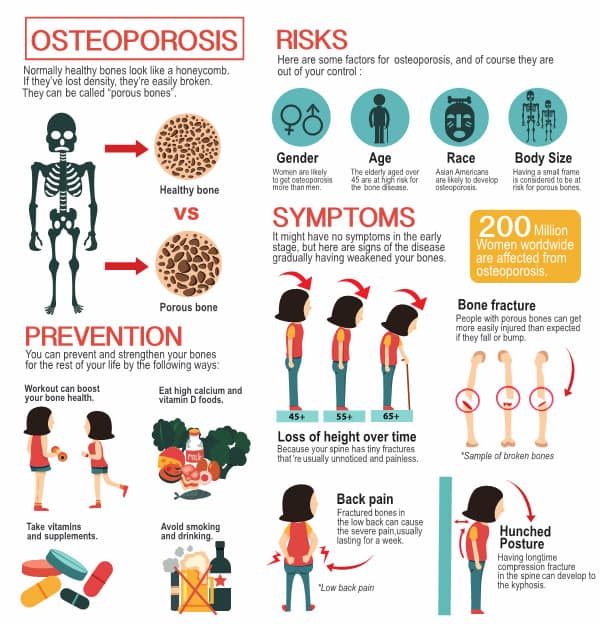 Understanding Osteoporosis and Exercise for Seniors