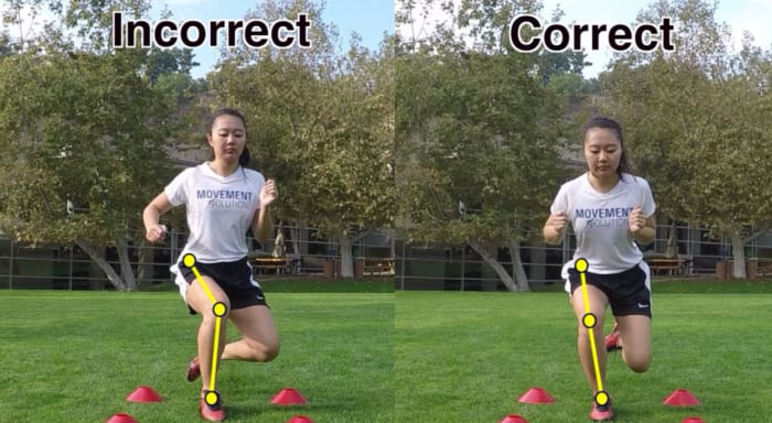 Poor Movement and Weak Hips Lead to ACL Tears